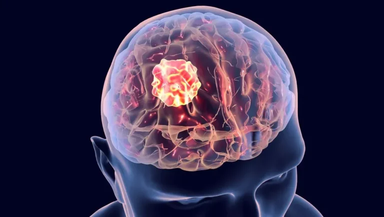 TBI Linked to Increased Risk for Malignant Brain Tumor