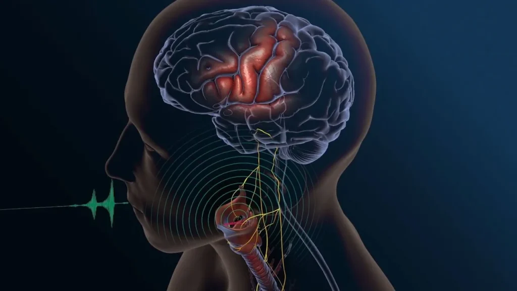 To measure latency, the researchers employed speech detection methods, which allowed them to identify the brain signals indicating the start of a speech attempt. Credit: StackZone Neuro