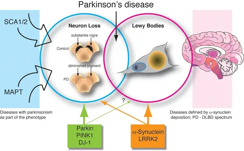 Researchers did not observe immediate brain signal changes, but after 12 sessions, they saw a measurable change in the brain signals responsible for motor control and movement. Credit: StackZone Neuro