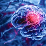 Head Injuries May Raise Brain Cancer Risk: Major Studies Reveal 5 Head Injuries May Raise Brain Cancer Risk